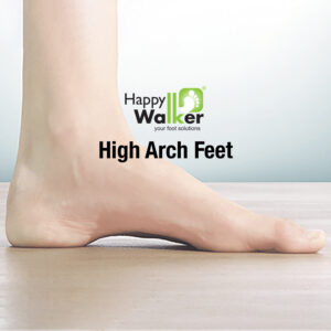 High Arch Feet